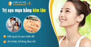 Gợi ý cách trị sẹo lõm lâu năm hiệu quả tiết kiệm thời gian 2