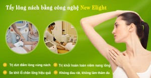 Triệt lông nách vĩnh viễn5