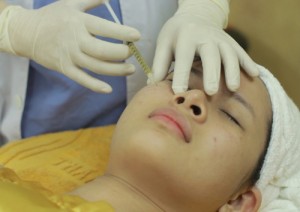 Bí quyết “vàng” trị sẹo lõm trên mặt bằng 4 loại củ quả thiên nhiên6