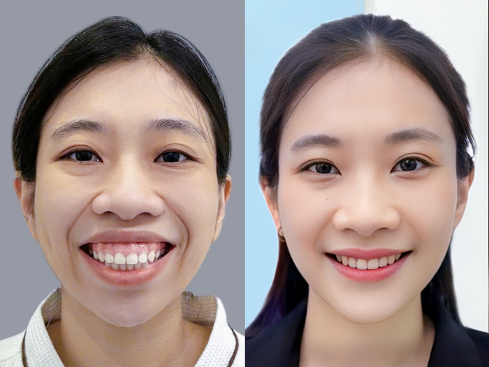 Bóc phốt thẩm mỹ Kangnam: Góc nhìn từ khách hàng thực tế