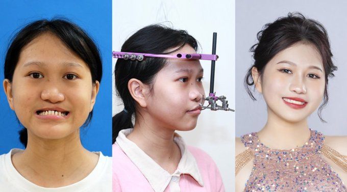 Thí sinh của chương trình Hành trình lột xác được Kangnam tái sinh